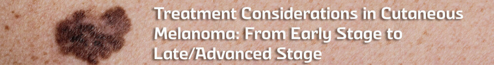 Treatment Considerations in Cutaneous Melanoma: From Early Stage to Late/Advanced Stage